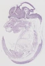 EMAGE:19261
