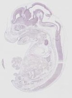 EMAGE:19267