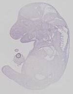 EMAGE:19276