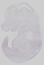 EMAGE:19276