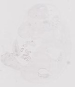 EMAGE:19282