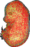 EMAGE:19287