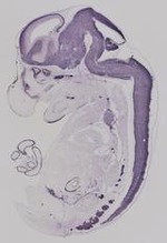 EMAGE:19299