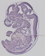EMAGE:19308