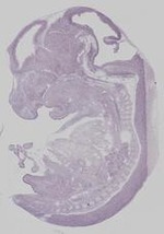 EMAGE:19360