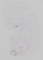 EMAGE:19362