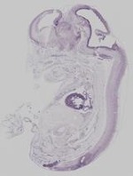 EMAGE:19372