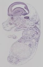 EMAGE:19372
