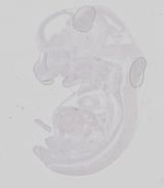 EMAGE:19576