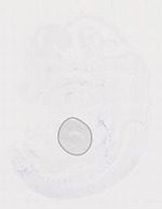 EMAGE:19913