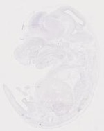 EMAGE:19928