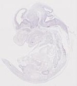 EMAGE:19957