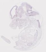 EMAGE:19957