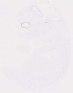 EMAGE:20001