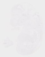 EMAGE:20009