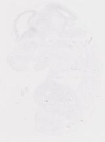 EMAGE:20009