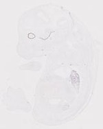 EMAGE:20010