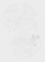 EMAGE:20010