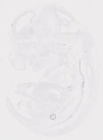 EMAGE:20010