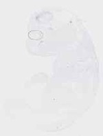 EMAGE:20039