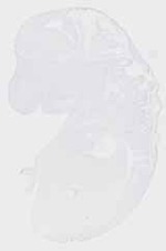 EMAGE:20041