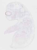EMAGE:20043