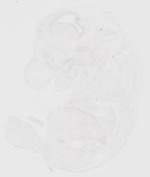EMAGE:20056