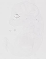 EMAGE:20074