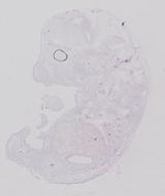 EMAGE:20083