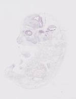 EMAGE:20084