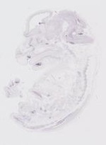 EMAGE:20084
