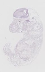 EMAGE:20086