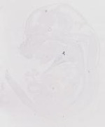 EMAGE:20089