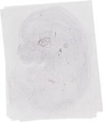 EMAGE:20089