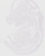 EMAGE:20095