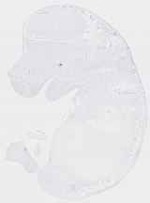 EMAGE:20104
