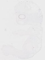 EMAGE:20107