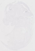 EMAGE:20107