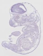 EMAGE:20115