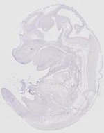 EMAGE:20116