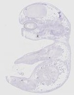 EMAGE:20116