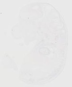 EMAGE:20136