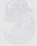 EMAGE:20163