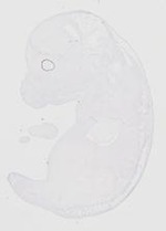 EMAGE:20163