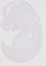 EMAGE:20164