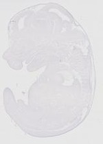 EMAGE:20164