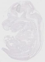 EMAGE:20167