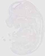 EMAGE:20169