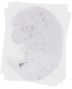 EMAGE:20207