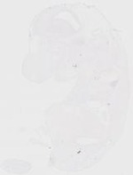 EMAGE:20218